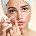 Know About Skin Problems